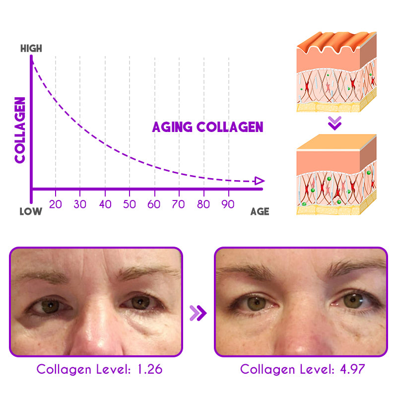 Pro-Xylane Anti-Aging Aktiv-Augencreme