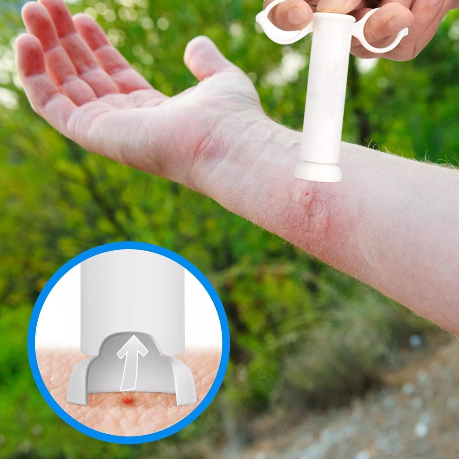 BiteAway-Saugentlastungswerkzeug | Schnelle & Natürliche Hilfe bei Insektenstichen - 1 + 1 Gratis!