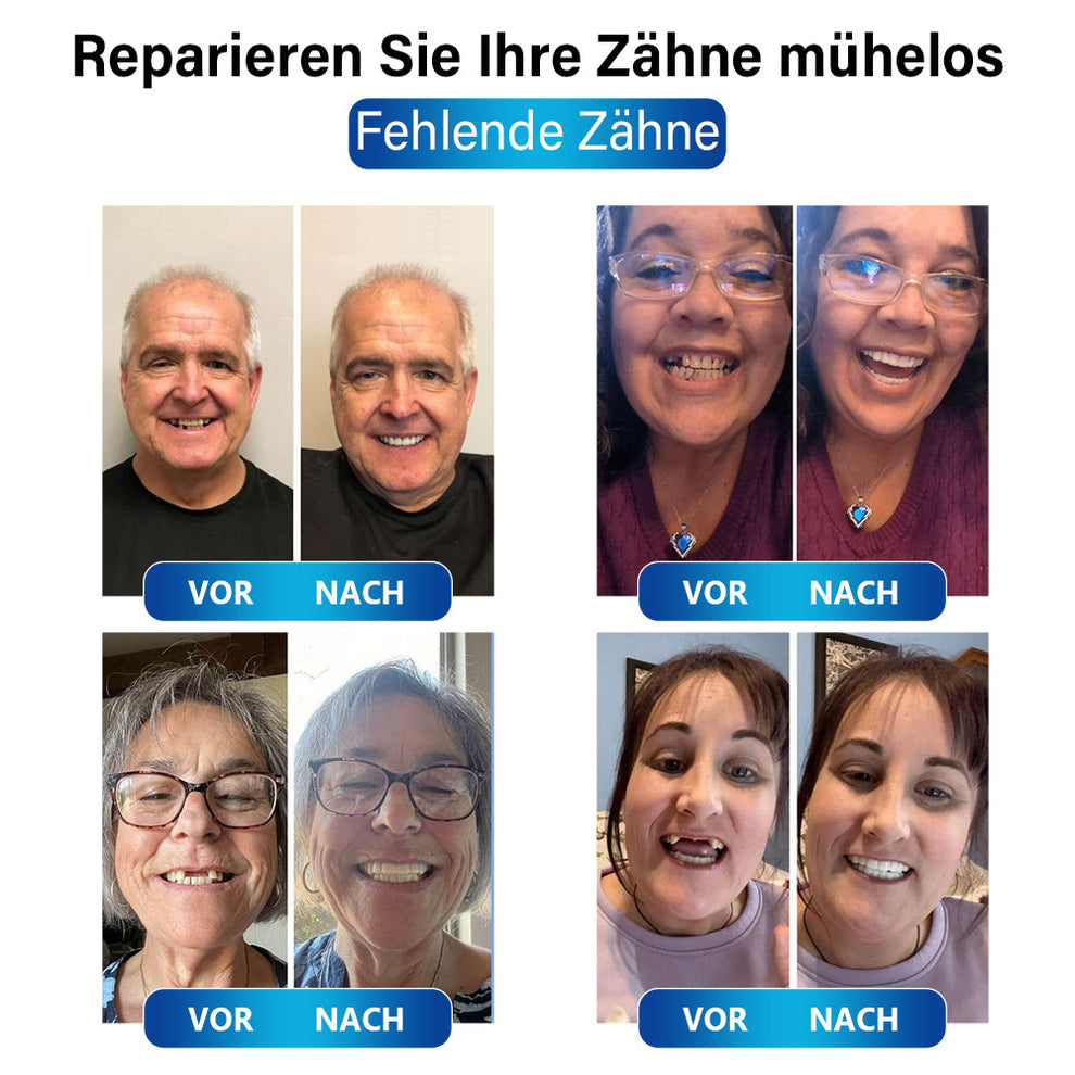 Dental-Blaulicht-Reparaturset | Schnelle Lösung für Zahnrestaurationen