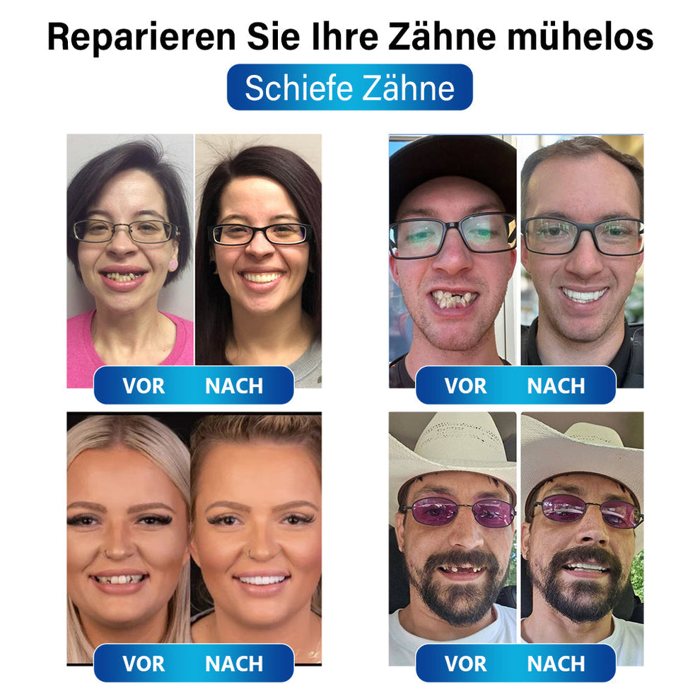 Dental-Blaulicht-Reparaturset | Schnelle Lösung für Zahnrestaurationen