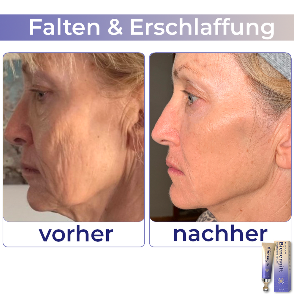 Collagen+ Bienengift Augencreme Roll-on | Sofortige Augenverjüngung