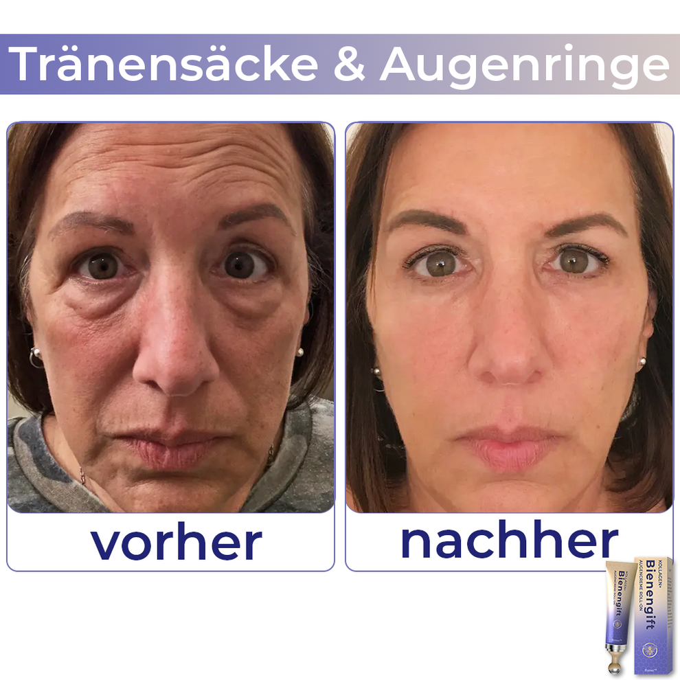 Collagen+ Bienengift Augencreme Roll-on | Sofortige Augenverjüngung