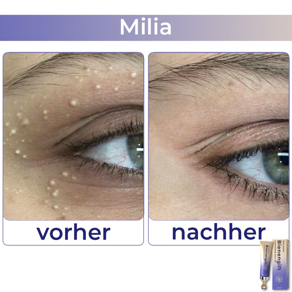 Collagen+ Bienengift Augencreme Roll-on | Sofortige Augenverjüngung