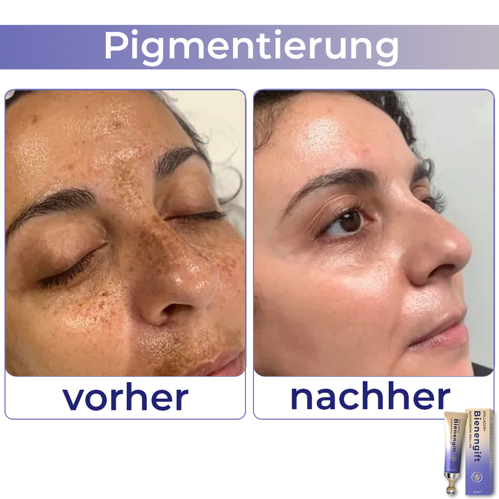 Collagen+ Bienengift Augencreme Roll-on | Sofortige Augenverjüngung