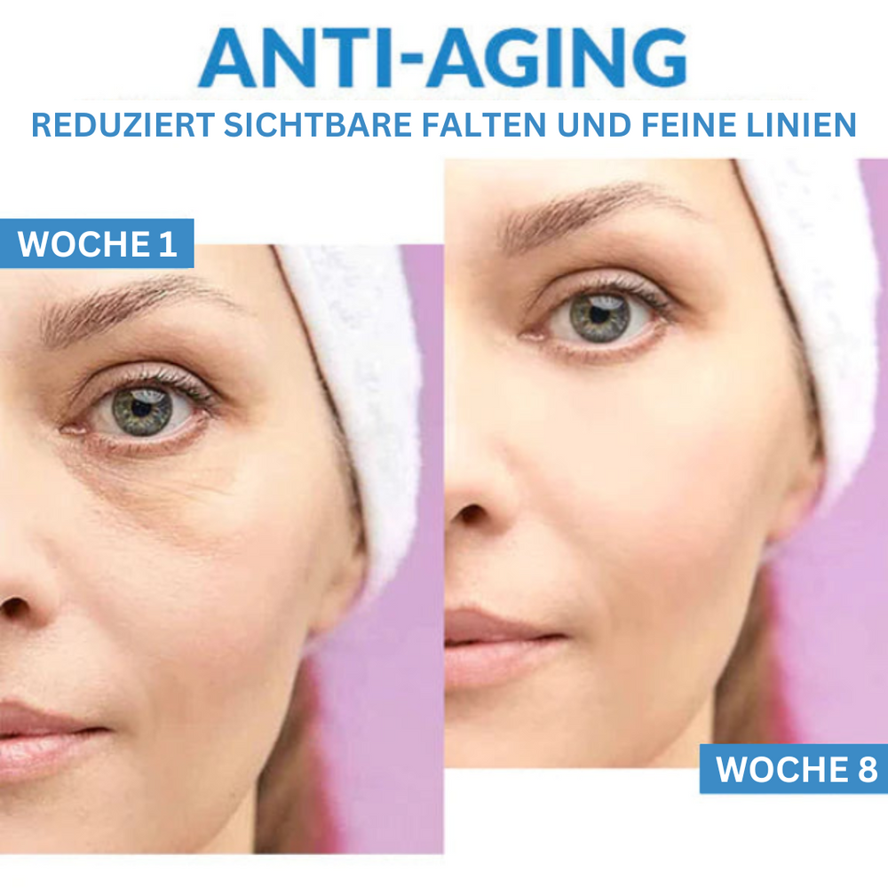 Augenverjüngungs-Creme | Sofortige Augencreme Gegen Schwellungen und Dunkle Augenringe - 1 + 1 Gratis!