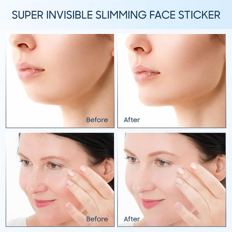 SkinLift-Pflaster | Sofortige Straffung und Ausstrahlung - 1 + 1 Gratis!