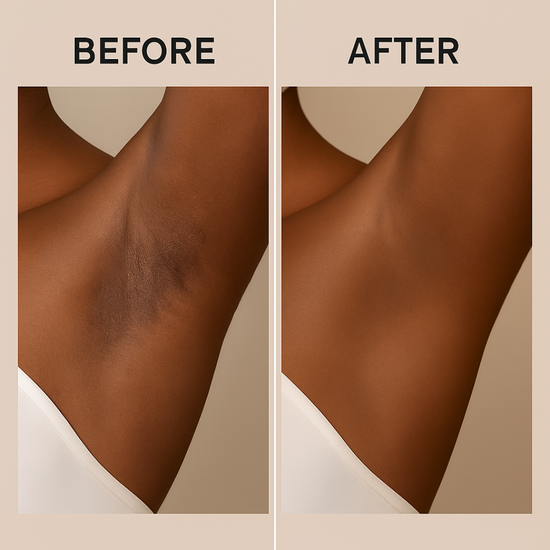 Reinigendes Peeling-Gel | Sofort glatte und strahlende Haut - 1 + 1 Gratis!